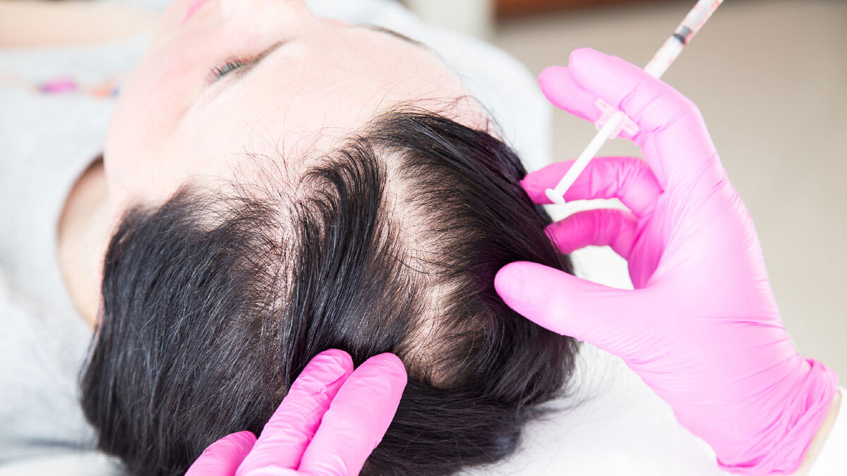 تزریق هیرفیلر در شیراز