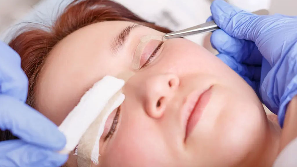 معرفی ۱۰ دکتر جراح بلفاروپلاستی معتبر در شیراز