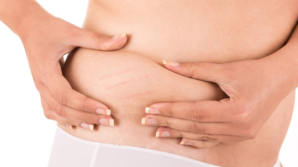 بهترین دکتر ترک پوستی در شیراز