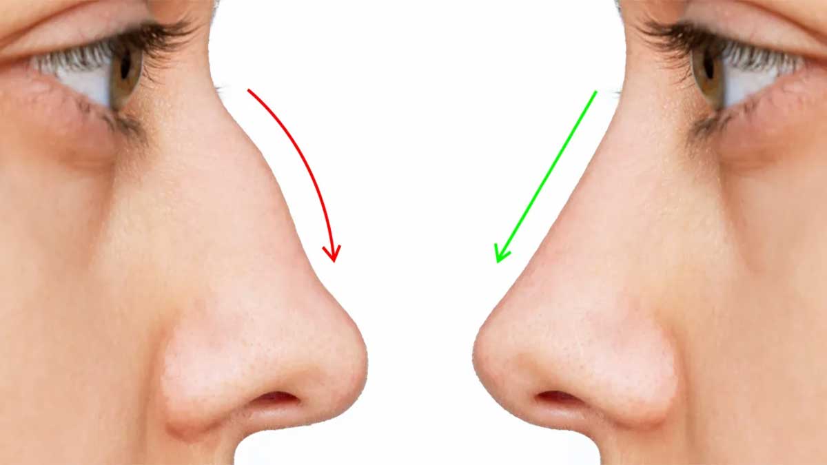 معرفی ۱۰ دکتر برتر لیفت بینی در شیراز