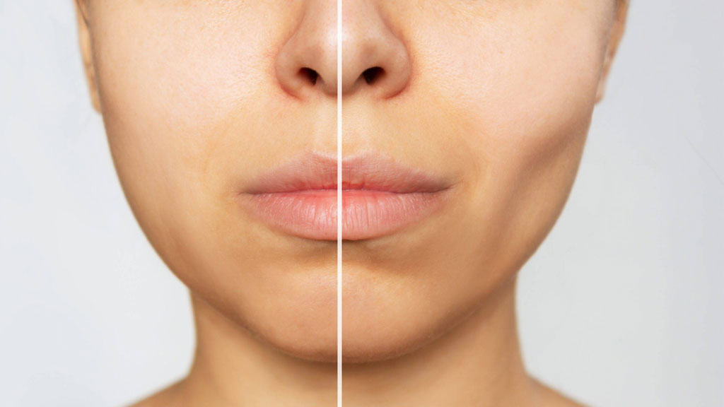 معرفی ۱۰ دکتر برتر جراحی بوکال فت در شیراز