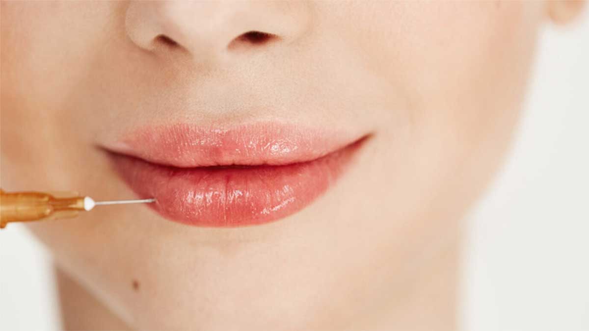 معرفی ۱۰ دکتر برتر تزریق فیلر لب در شیراز