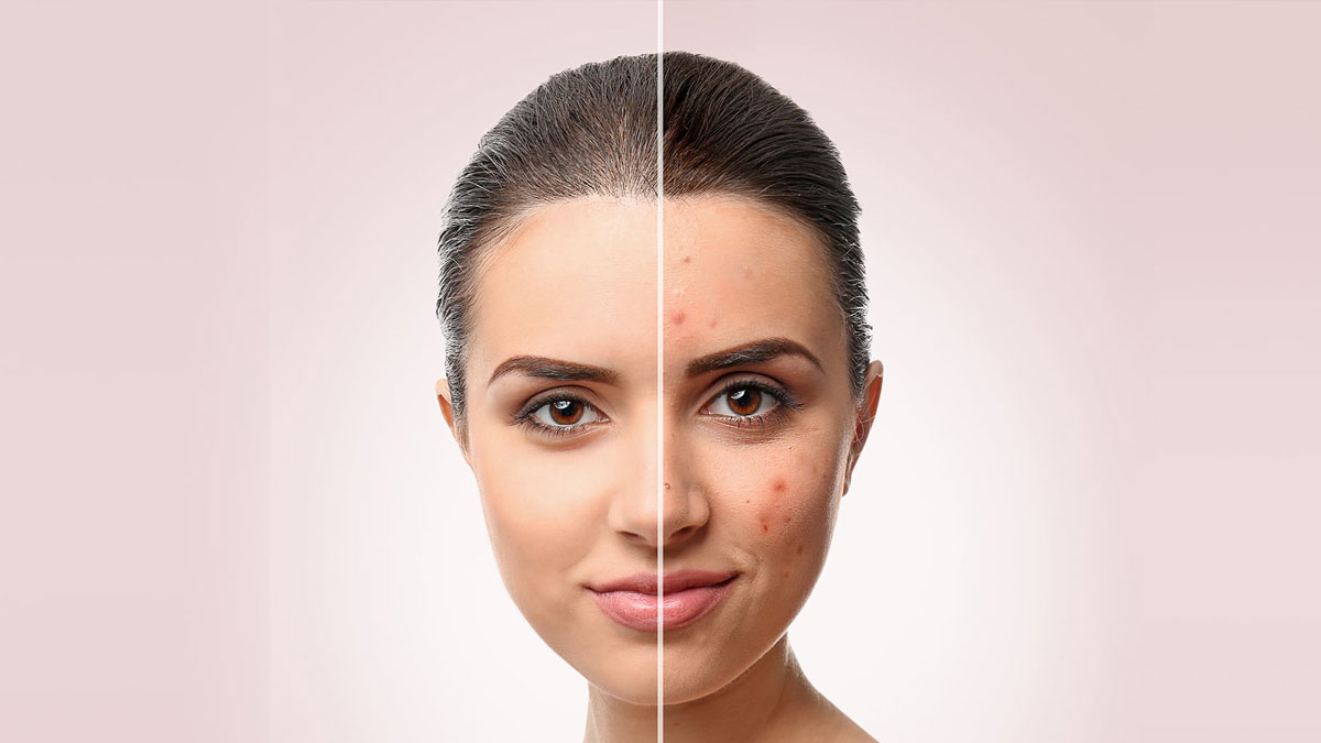 معرفی 10 دکتر برتر درمان جوش در شیراز