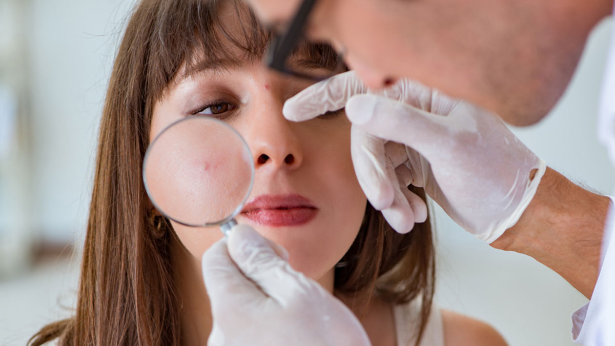 معرفی 10 دکتر برتر درمان جوش در شیراز