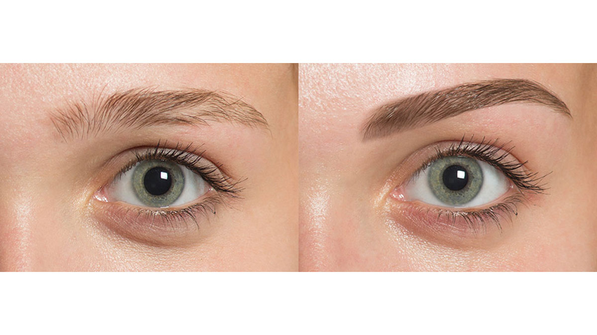 کاشت ابرو در شیراز