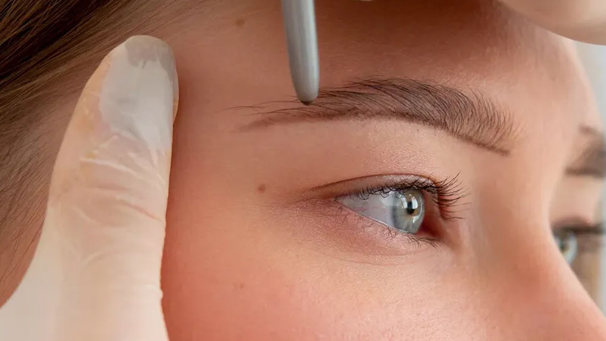 کاشت ابرو در شیراز