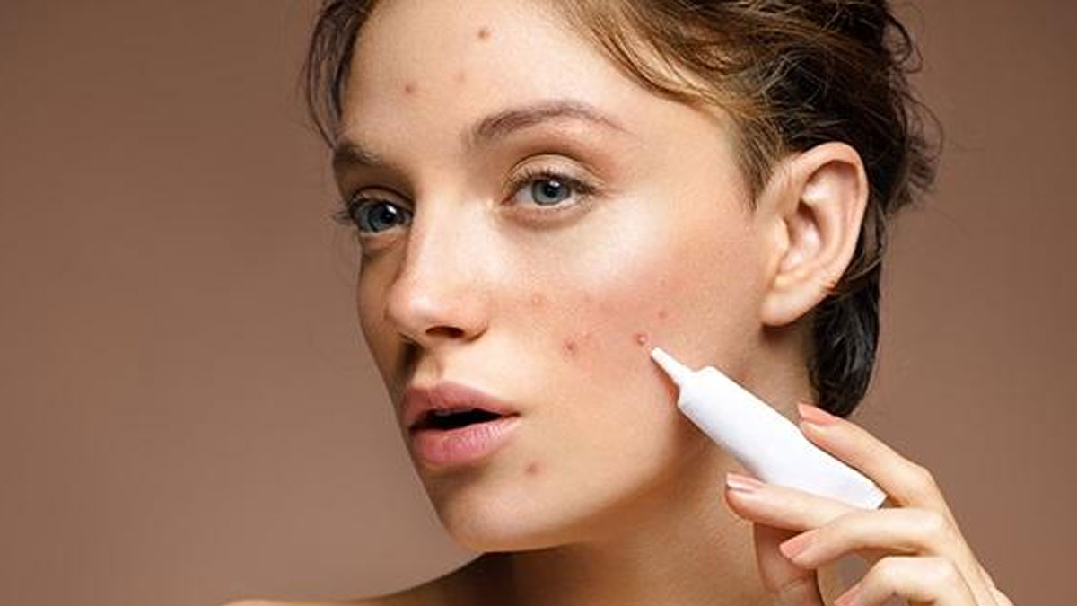 بهترین دکتر درمان آکنه در شیراز